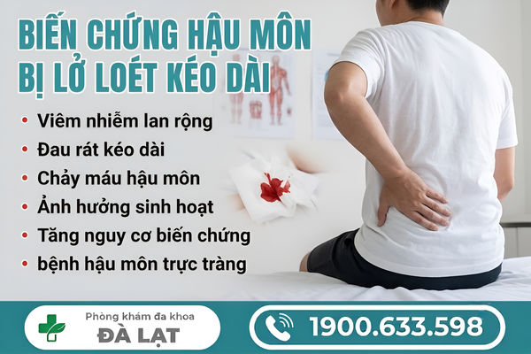 Hình ảnh minh họa
